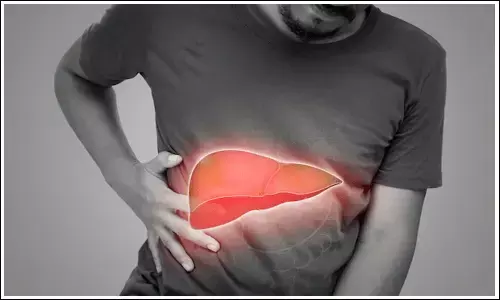 Causes of Liver Disease