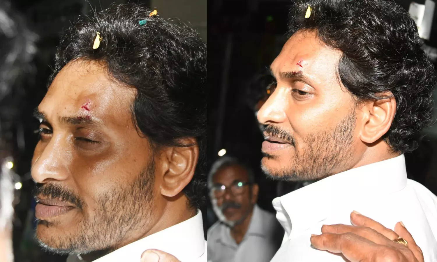 Breaking : జగన్ పై దాడి ఘటన పై కేసు నమోదు