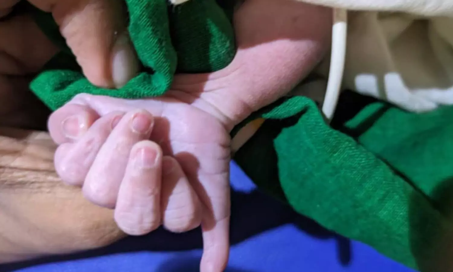 శిశువు చేతికి 13 వేళ్లు.. దైవానుగ్రహం అంటున్న కుటుంబం శిశువు చేతికి 13 వేళ్లు.. దైవానుగ్రహం అంటున్న కుటుంబం