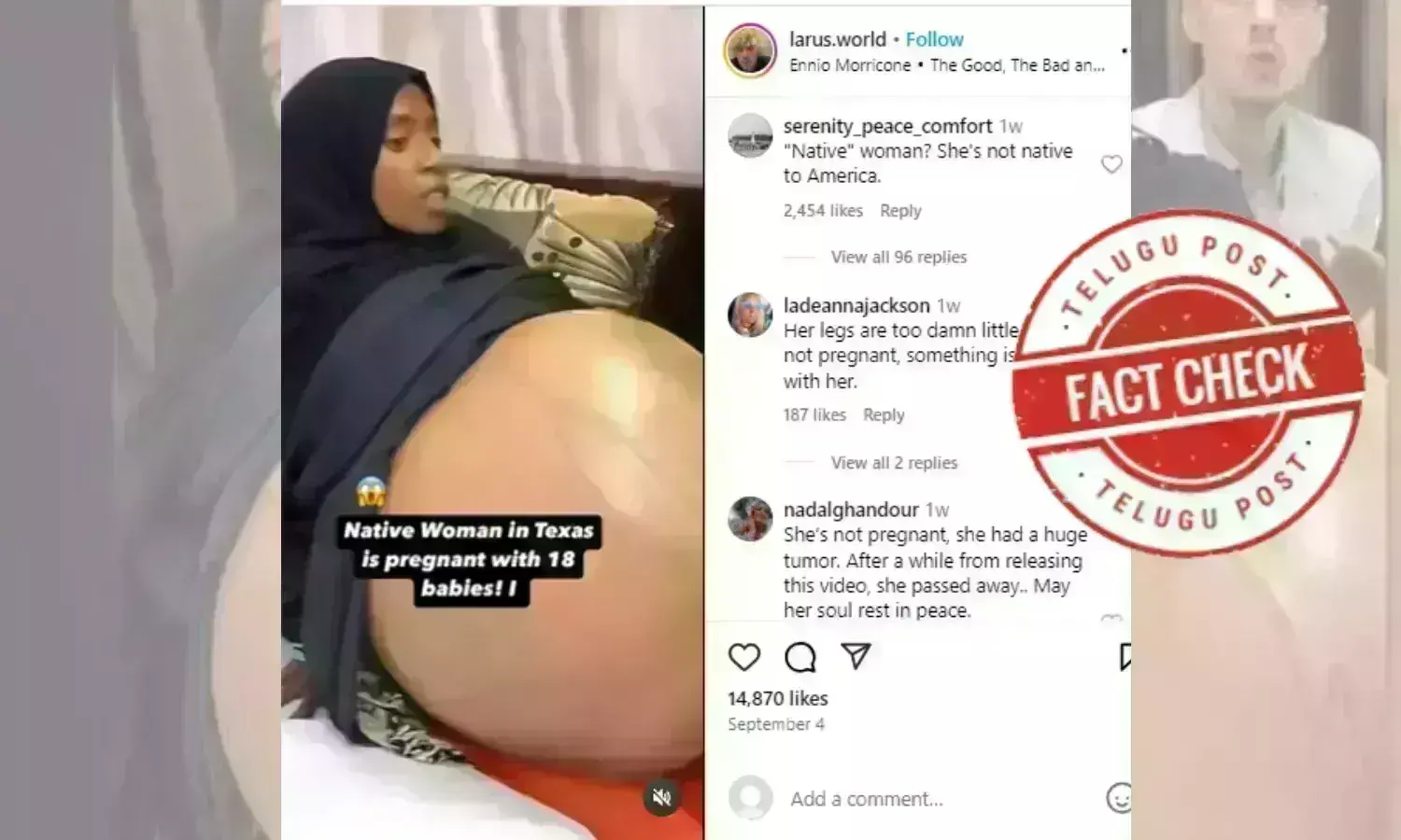 Al Thawra Modern General Hospital, Dr Samah, Mona Bilquis Saeed,  massive tumour, Yemeni woman, viral video