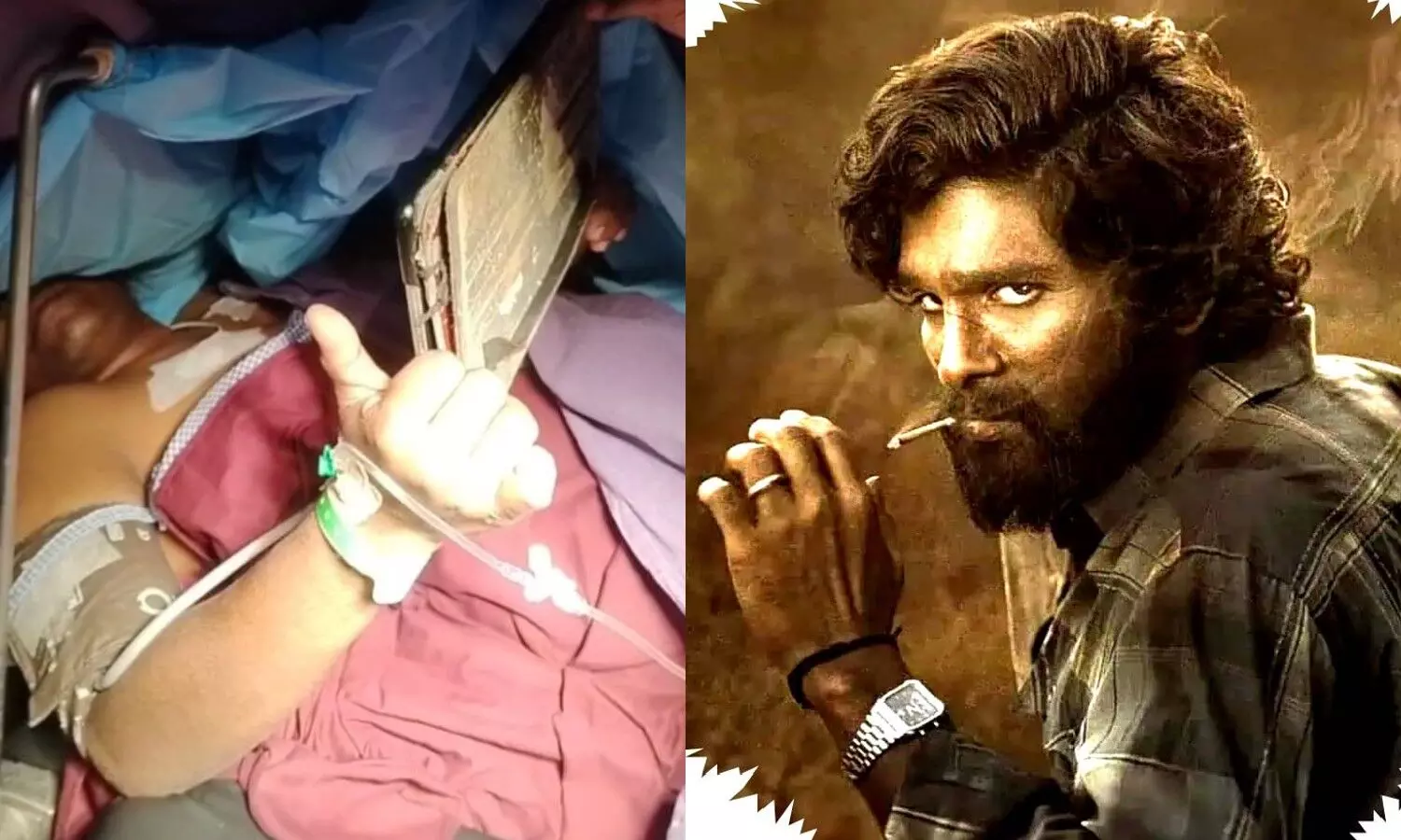 PushpaMovie, Begumpet, KimsSunShineHospital, Doctors, Surgery PushpaMovie, Begumpet, KimsSunShineHospital, Doctors, Surgery