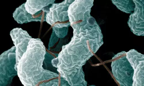 guillain barre syndrome, case, maharashtra, hyderabad