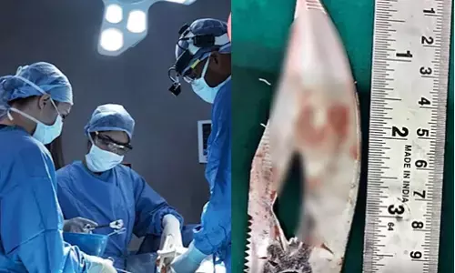 కంటి నుండి ముక్కులోకి కత్తి ముక్క.. ప్రాణాలు కాపాడిన వైద్యులు