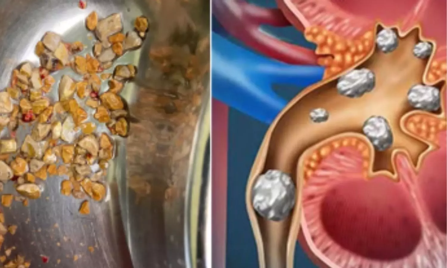 పిల్లల కిడ్నీలపై తల్లిదండ్రులు దృష్టి పెట్టాల్సిందే!!