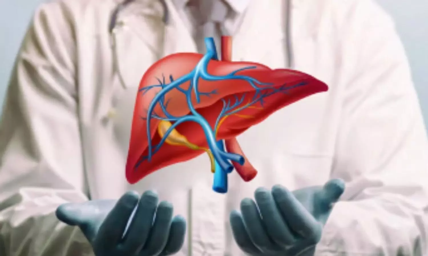 కోమాలోకి వెళ్ళిపోయింది.. ఉచితంగా లివర్‌ ట్రాన్స్‌ప్లాంటేషన్‌ చేసి బతికించారు