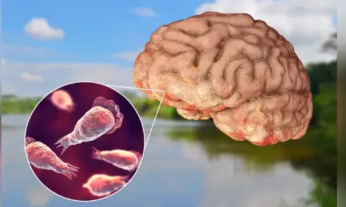 death toll, brain infection,  five peopledied  kerala