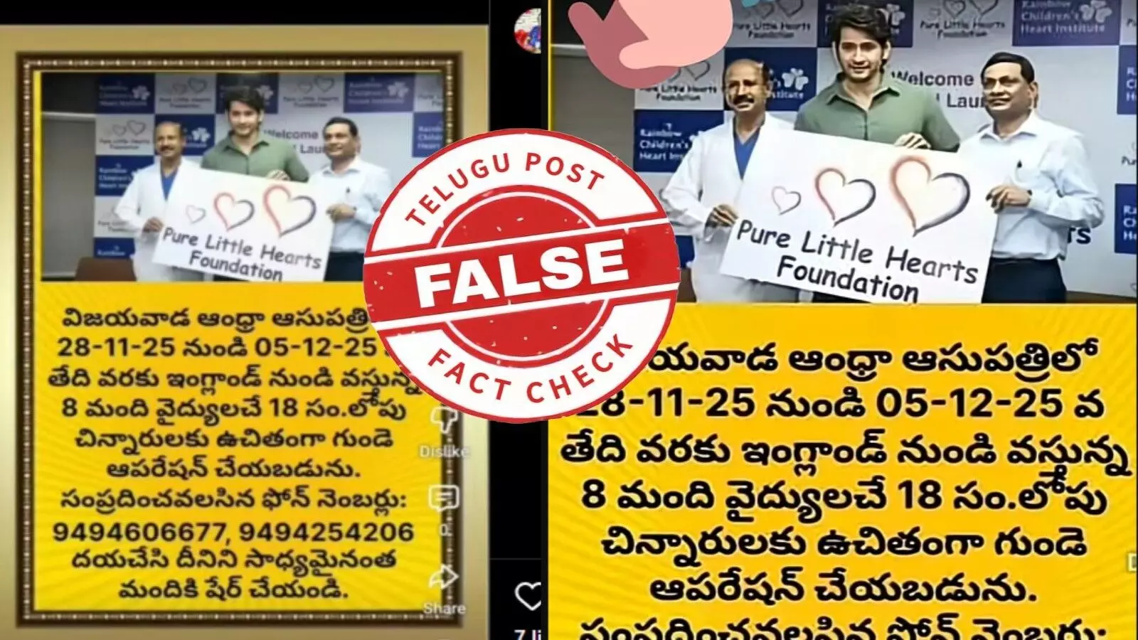 ఫ్యాక్ట్ చెకింగ్: విజయవాడలోని ఆంధ్ర ఆసుపత్రిలో నవంబర్ 28 నుండి చిన్నారులకు ఉచితంగా హార్ట్ ఆపరేషన్లు చేయడం లేదు ఫ్యాక్ట్ చెకింగ్: విజయవాడలోని ఆంధ్ర ఆసుపత్రిలో నవంబర్ 28 నుండి చిన్నారులకు ఉచితంగా హార్ట్ ఆపరేషన్లు చేయడం లేదు