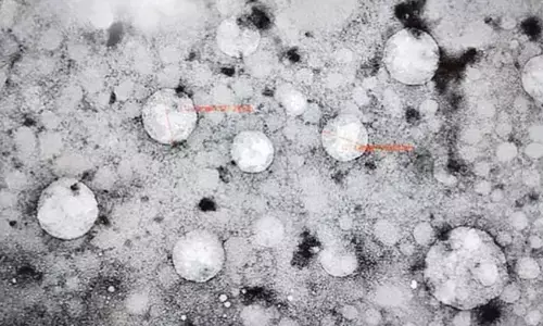 కాలేయానికి లైఫ్ ఇచ్చే తులసి-28ఎక్స్‌