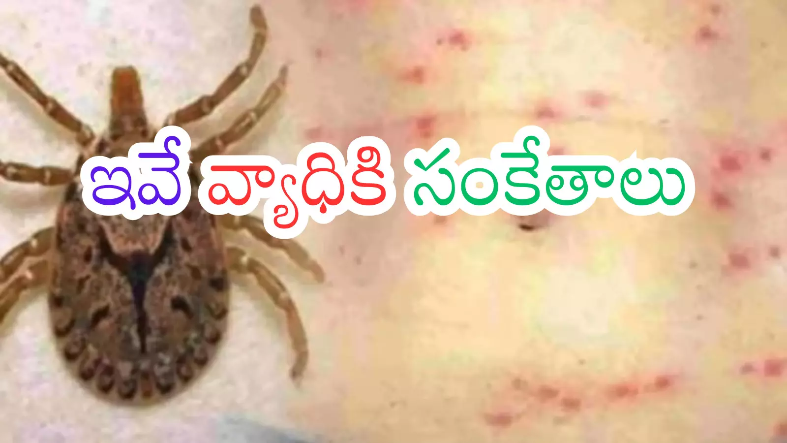 Andhra Pradesh : ఆంధ్రప్రదేశ్ ను వణికిస్తున్న స్క్రబ్ టైఫస్ వ్యాధి Andhra Pradesh : ఆంధ్రప్రదేశ్ ను వణికిస్తున్న స్క్రబ్ టైఫస్ వ్యాధి