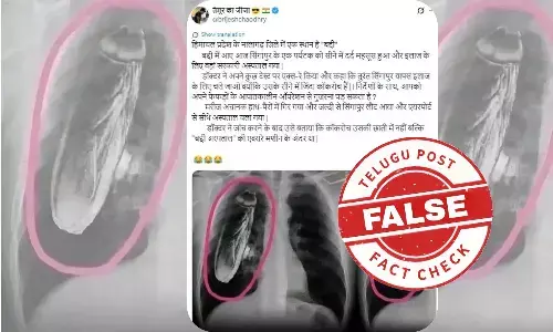 Cockroach in X-ray, Solan Regional Hospital, Singapore tourist, Normal chest X-ray, Dr Frank Gaillard