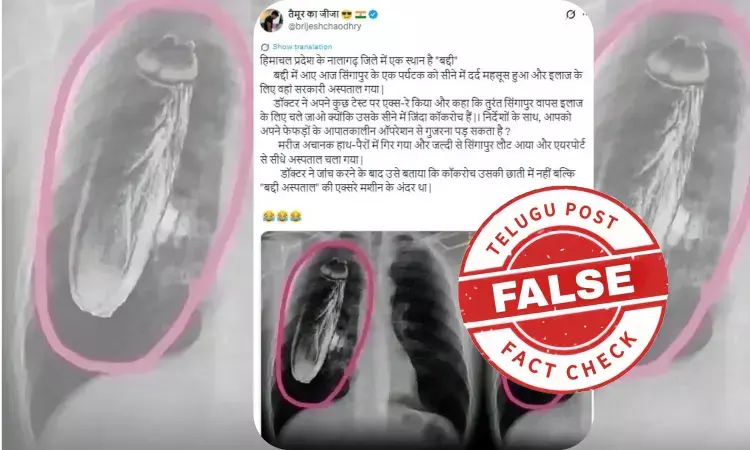 Cockroach in X-ray, Solan Regional Hospital, Singapore tourist, Normal chest X-ray, Dr Frank Gaillard