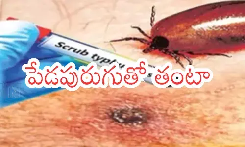 scrub typhus disease is plaguing andhra pradesh scrub typhus disease is plaguing andhra pradesh