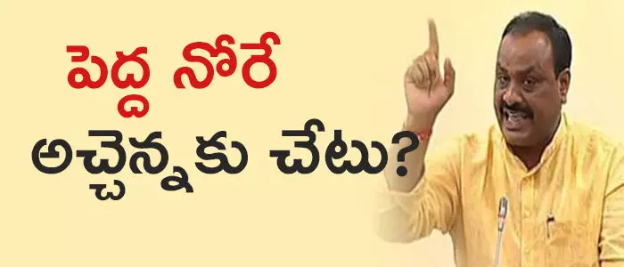 అచ్చెన్నాయుడు