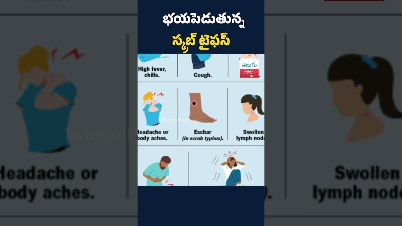 భయపెడుతున్న స్కబ్ టైఫస్ #telugupost  #latestnews #news