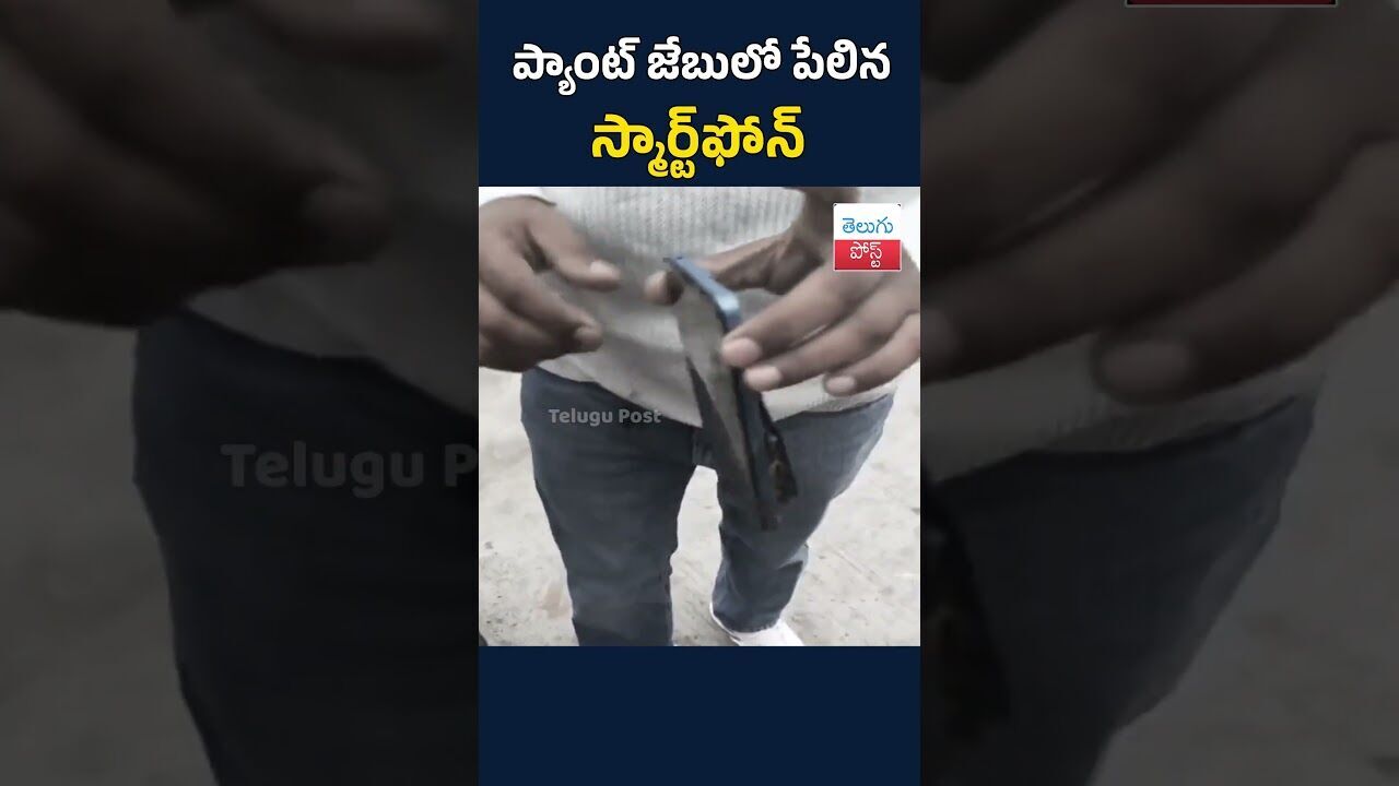ప్యాంట్ జేబులో పేలిన స్మార్ట్ఫోన్#mobileblast #PhoneExplosion #batteryissues #upnews ప్యాంట్ జేబులో పేలిన స్మార్ట్ఫోన్#mobileblast #PhoneExplosion #batteryissues #upnews